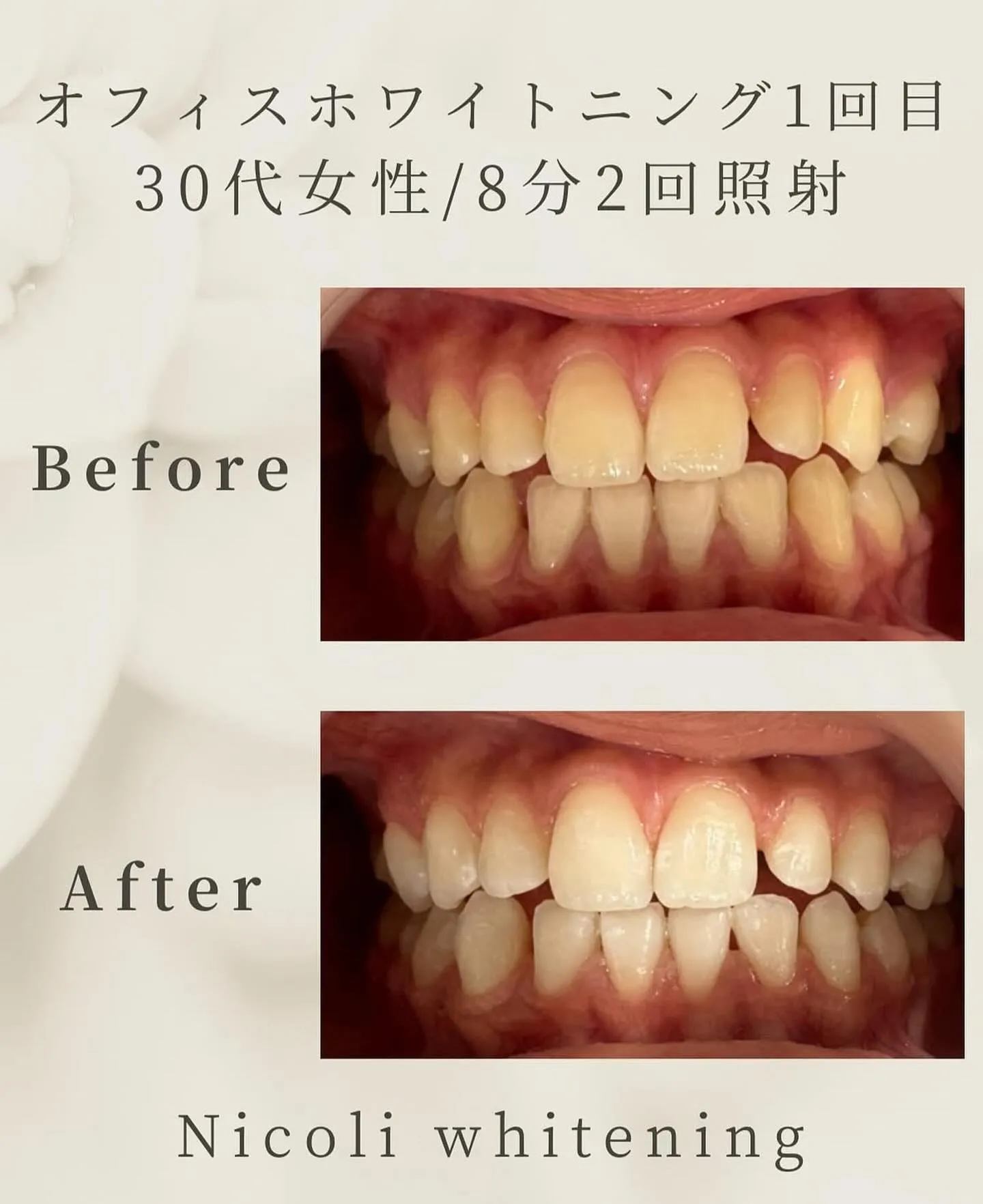 1回でトーンアップしました🫧
